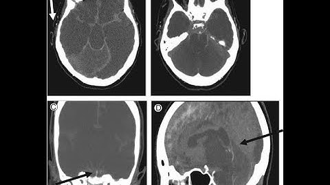 He played Getting Over It with CONTROLLER, this is what happened to his brain!