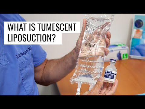 Video: Doare liposucția tumescentă?