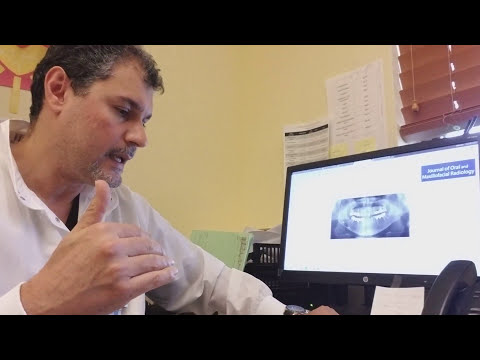 فيديو: هل سيظهر سرطان الفم على الأشعة السينية؟