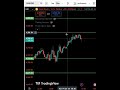 Gold Price Action Update XAU/USD Daily Analysis 📊 | #trading #bestgoldforexsignals #tradesetup