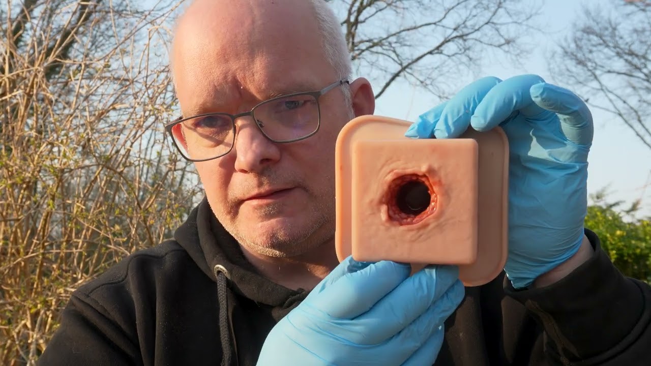 Medizinische Leckagen STOPPEN Mit EINFACHER Technik