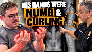 He Injured His Elbow… Then BOTH Hands Started Going Numb | Dr. Rahim Chiropractic