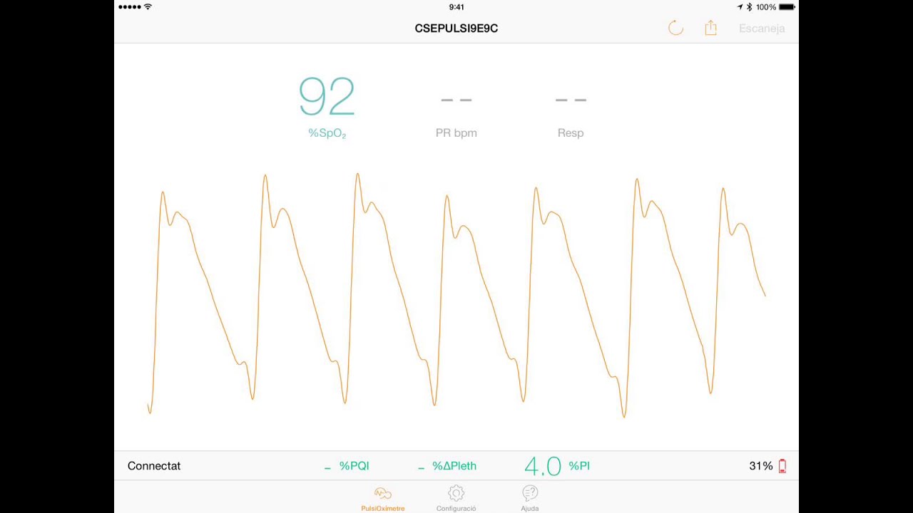 PulseOximeter app for iOS