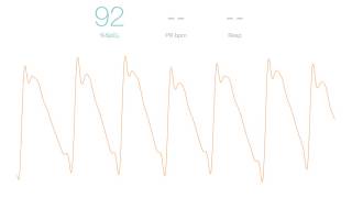 PulseOximeter app for iOS screenshot 1