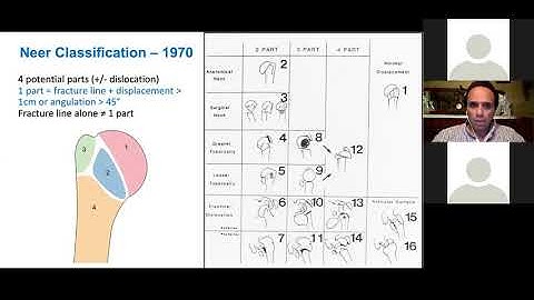 PROF SHERIF KHALED FR PROXIMAL HUMERUS