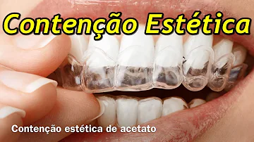 O que é placa de contenção?