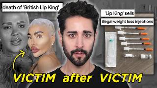 Famous The Lip King: Fame, Fillers, and FATAL Cosmetic Procedures Wealth