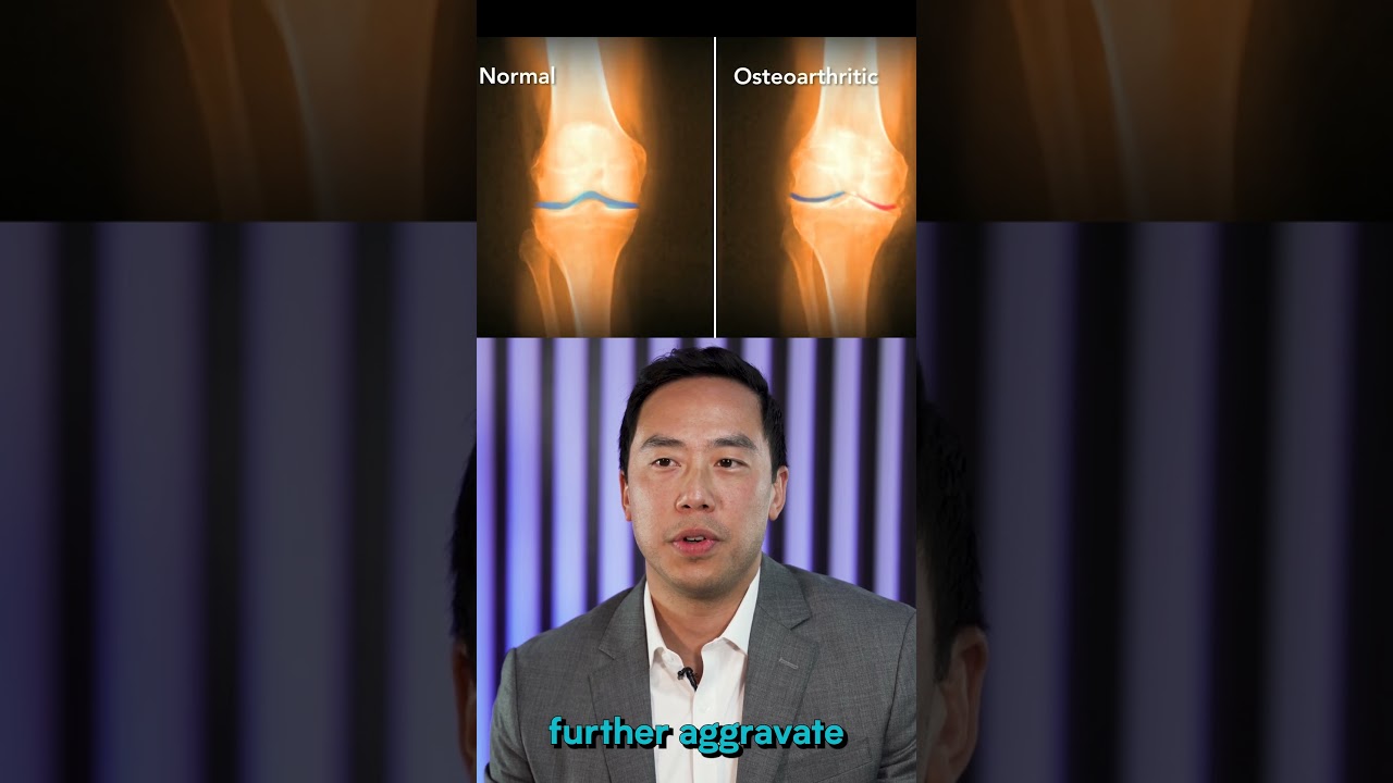 **Immunis' investigational secretome product, formerly known as STEM, is now referred to as IMMUNA.