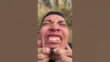 How I Cured a Bug Bite with Yogurt in the Wild Survival Hacks