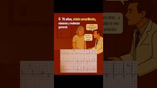 Intoxicacin Digitlica el Ecg Que Nunca Debes Pasar Por Alto