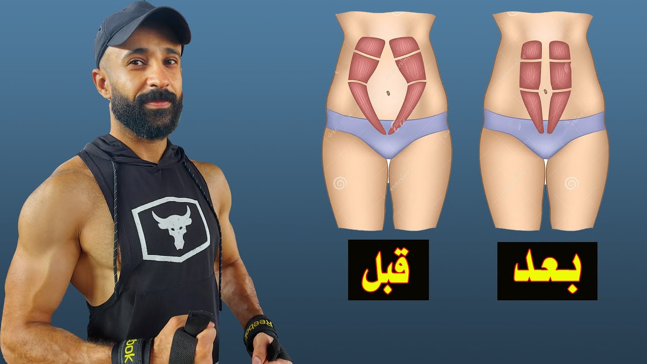 افضل تمارين للانفصال العضلي للبطن