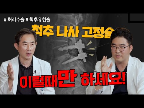 철심 박는 수술 = 척추유합술 이럴 땐 꼭 필요하다!