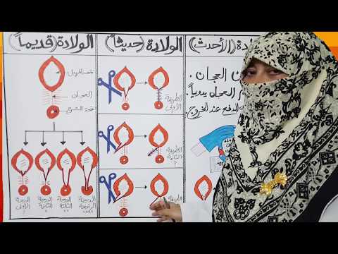 هل الافضل شق العجان وعمل خياطة مع الولادة الطبيعية؟؟