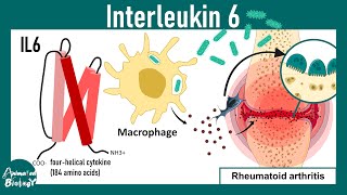 Interleukin 6 | Interleukin 6 signaling | Interleukin 6 inhibitors | USMLE