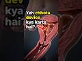 Copper-T kaise pregnancy🤰 rokta hai? Sach jaan lo!#CopperT #IUCD#contraceptivemethods #shorts