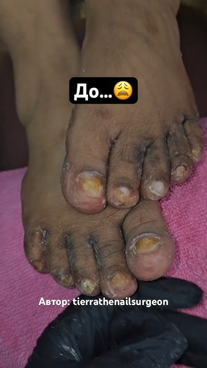 Розовые ногти🫣 Наращивание на БОЛЬНЫЕ НОГТИ🤔 Автор ...