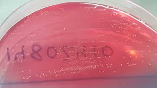 Enterococcus Gallinarum Growth On Cled Agar Uropathogen