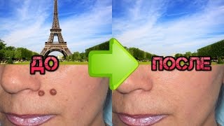 Как удалить ненужные элементы на фотографии screenshot 5
