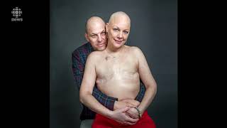 Leah Biegler bares her scars as a cancer survivor