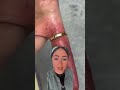 لو دبله اتحشرف في صباعك تعملي ايه اكسبلور  تيك توك  ترند