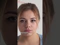 Blepharoplasty in Mexico: Stunning 10-Year Transformation
