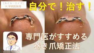 巻き爪矯正/ 最新の治療！自分で！簡単に！手術せずに痛みからの解放！【ネイル・エイド】大学病院採用・一般医療機器・巻き爪矯正　 Ingrown toenail correction device