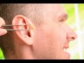 Ear acupuncture  auriculotherapy 06 auricular medicine overview anatomical terminology