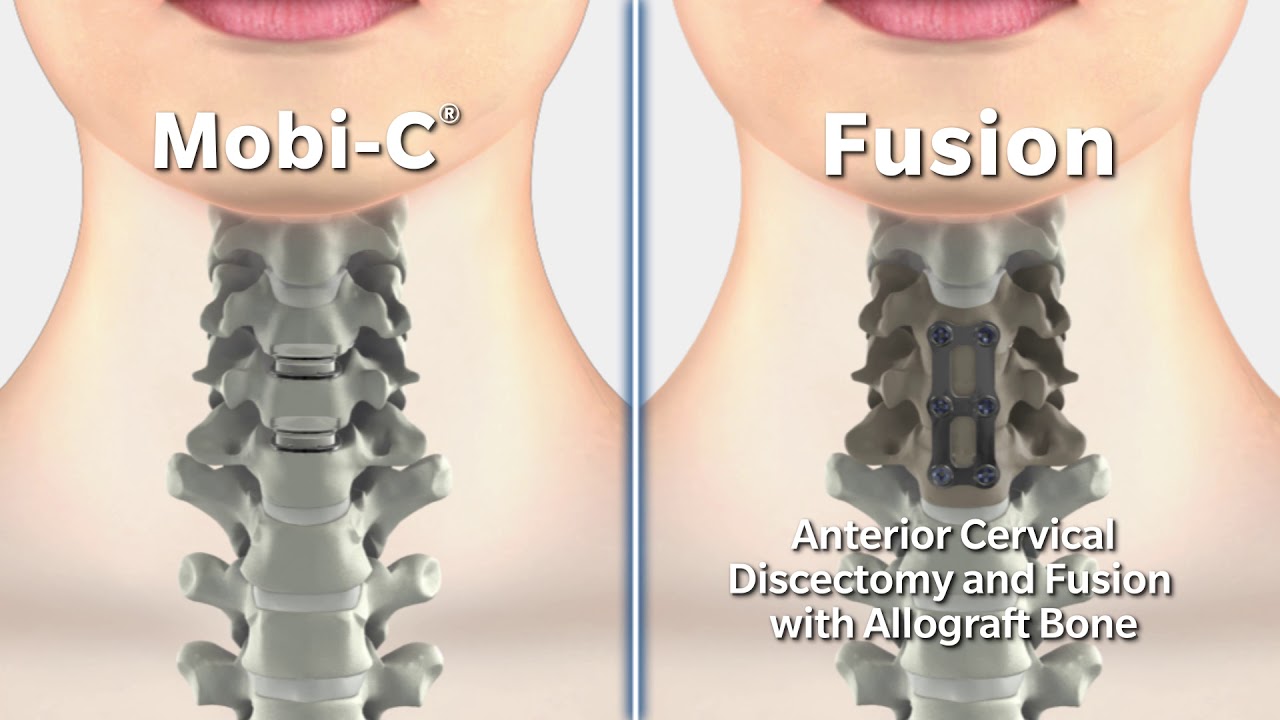 Mobi C vs  Fusion Animation
