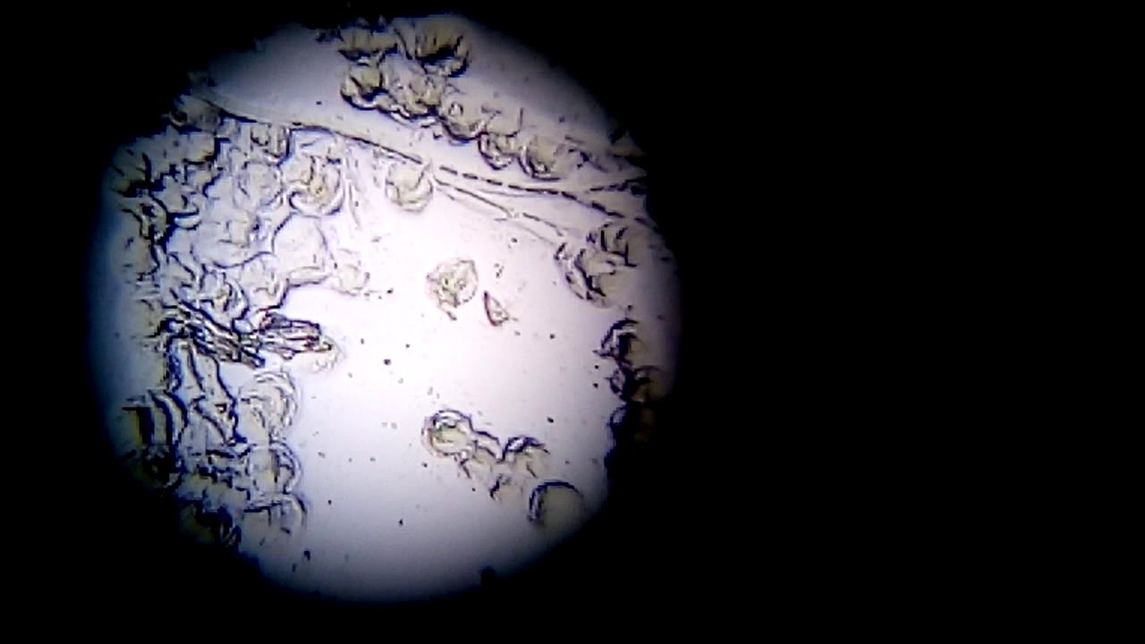 Microscopic view of zoothamnium .sp