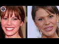 NIKKI COX - ( Plastic Surgery Before and After | Face )  - BOTCHED PLASTIC SURGERY FAILS