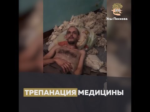 Видео: Зачем делают трепанацию черепа?