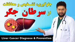 جلوگیری از سرطان جگر و چطور از سرطان جگر محافظت و تشخیص کنیم؟ ❤ Liver Cancer Prevention & Diagnose