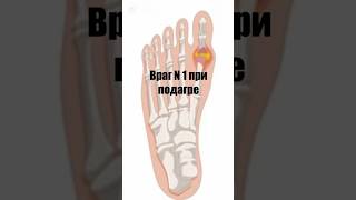 Враг номер 1 при подагре. #fyp #здоровье #питание #рацион #ураты #нутрициолог
