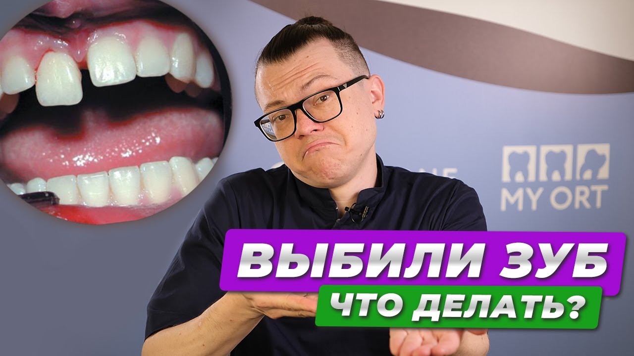 Что делать, если выбили зуб #стоматология #выбитыйзуб #lifestylemedicine