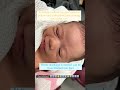 Hey Pediatrician I Can T Be Mellow My Newborn S Eyes Are All Yellow 