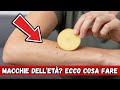 Macchie dell’età? Via in 20 minuti con una semplice patata 💥🤯