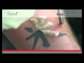 enlever les tatouages au laser.mp4