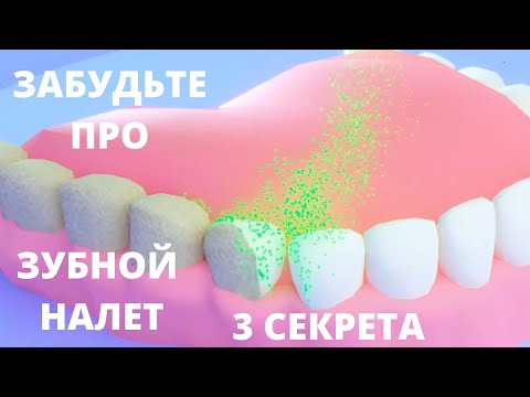Как убрать НАЛЕТ на ЗУБАХ/ чистка – ЗУБНОЙ НАЛЕТ удаление – Как избавиться от зубного налета