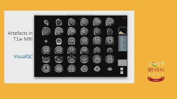 OHBM 2019 | Educational Courses | Tools and Informatics for niQC: overview