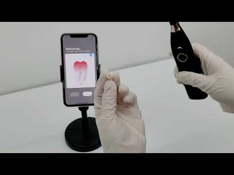 Smartooth Scanner SmarTooth | tradekorea