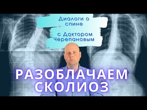 Сколиоз | Как отличить болезнь от плохой осанки? Как лечить сколиоз?