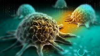 Cause of cancer detected from unexpected and unpreventable element HD video Image of Cause of cancer detected from unexpected and unpreventable element HD video