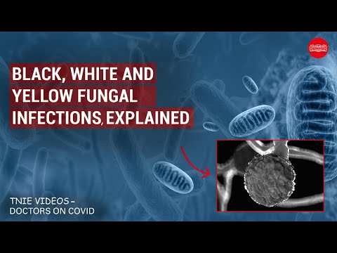 Black, white and yellow fungal infections, explained | Doctors on Covid-19