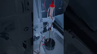 ‼️ Dialysis process💉 ‼️ #dialysis #urine #blood #ckdpatient #procedure #nurse #doctor #shortvideo