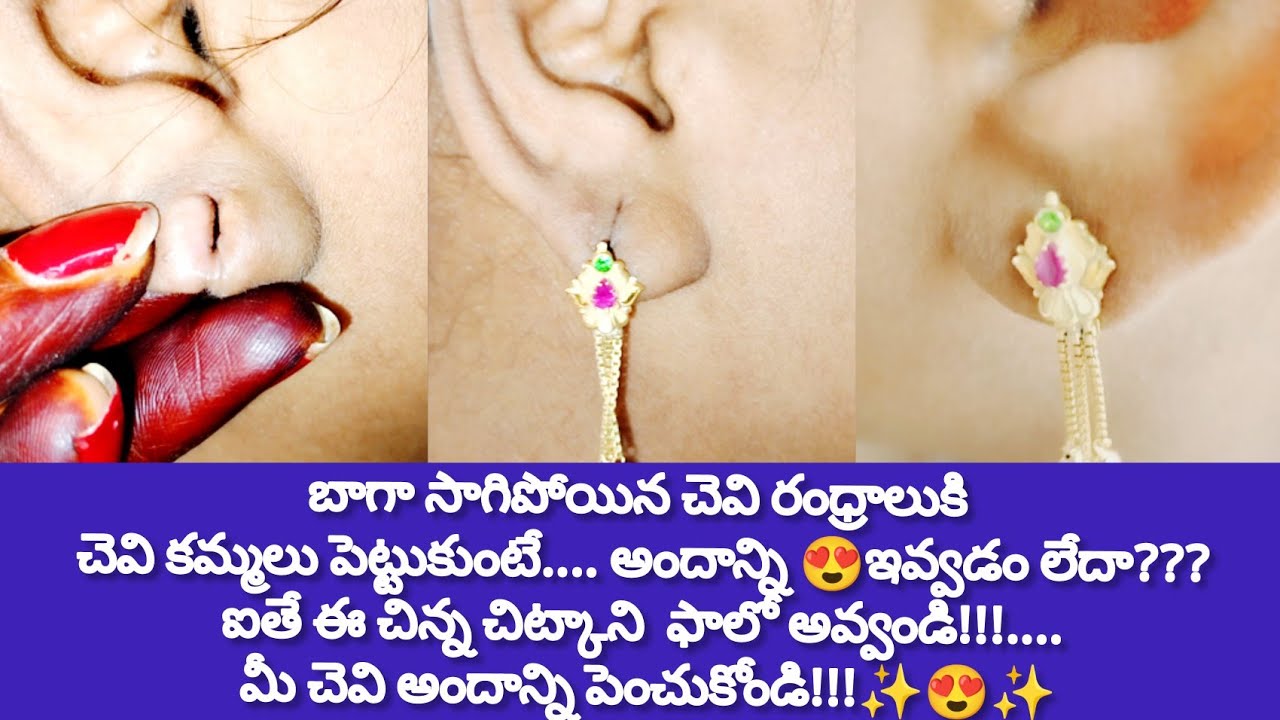 సాగిపోయిన చెవి రంధ్రాలుకి చెవి కమ్మలు పెట్టుకుంటే అందాన్ని ఇవ్వడం లేదా? ఐతే ఈ చిట్కా ఫాలో అవ్వండి!!