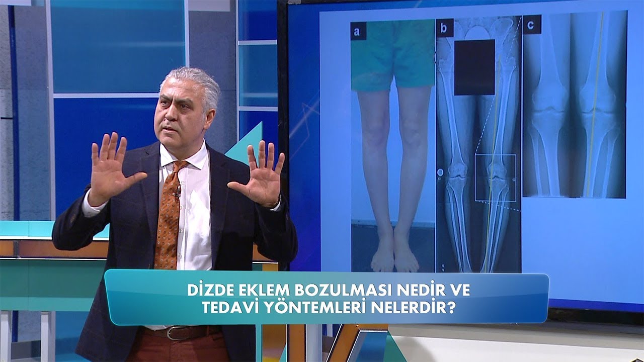 Dizde eklem bozulmasının tedavi yöntemleri nelerdir? Balçiçek İle Dr. Cankurtaran 85. Bölüm