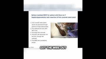 Watch How This Metal Stent Was Placed