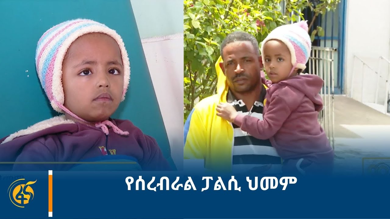 የሰረብራል  ፓልሲ  ህመም