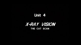 Geometry: New Tools for New Technologies: Unit 4: X-Ray Vision the CAT Scan screenshot 5