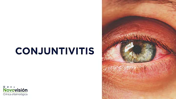 ¿Qué aspecto tiene la conjuntivitis?